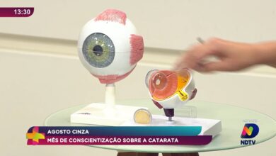 Agosto Cinza alerta sobre catarata e cuidados com a saúde ocular em SC
