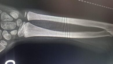 Mãe é presa por agredir filho de 9 anos com vassoura