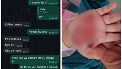 Madrasta confessa ter queimado mão de menina de 2 anos em SC