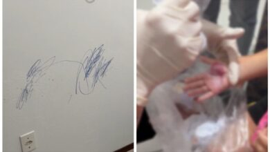 Madrasta queimou mão de menina por riscos na parede em SC