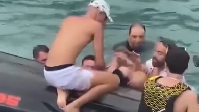 Mulher tem cabelo sugado por turbina de jet ski e sofre ferimento grave no Caixa D’Aço