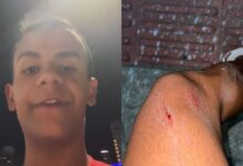 Jovem denuncia homofobia e ataque com pitbull em praia de SC