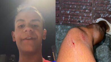 Jovem denuncia homofobia e ataque com pitbull em praia de SC