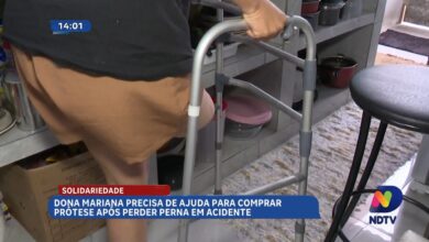 Moradora precisa de ajuda para recomeçar após perder a perna